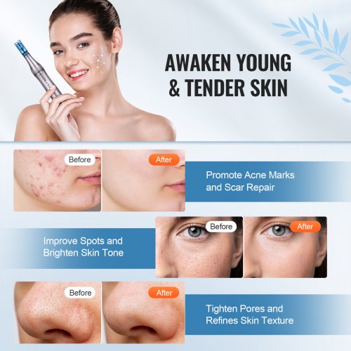 M8S Professional Microneedling Pen 6-Speed Electric Beauty Pen 12 Needles - Image 7